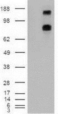 Western Blot: Patched 1/PTCH Antibody (OTI5C7)Azide and BSA Free [NBP2-73253]