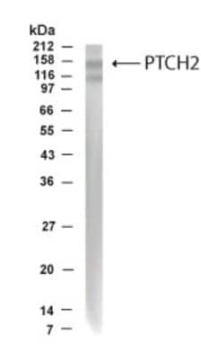 Western Blot: Patched 2/PTCH2 AntibodyBSA Free [NB200-119]