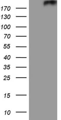 SDS-PAGE: Patched 2/PTCH2 Antibody (OTI8B5) [NBP2-45440]