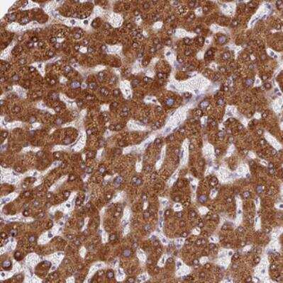 Immunohistochemistry: Patched Domain Containing 2 Antibody [NBP2-30688]