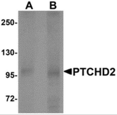 Western Blot: Patched Domain Containing 2 AntibodyBSA Free [NBP2-81764]