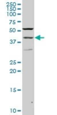 Western Blot: Pax2 Antibody (2E4) [H00005076-M02]