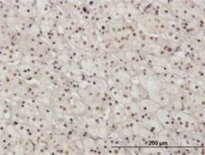 Immunohistochemistry-Paraffin: Pax2 Antibody (3C7) [H00005076-M01]