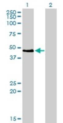 Western Blot: Pax2 Antibody (3C7) [H00005076-M01]