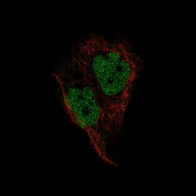 Immunocytochemistry/ Immunofluorescence: Pax2 Antibody (CL9469) [NBP2-88934]