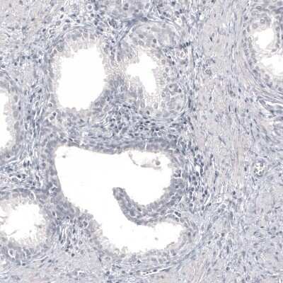 Immunohistochemistry-Paraffin: Pax2 Antibody (CL9469) [NBP2-88934]