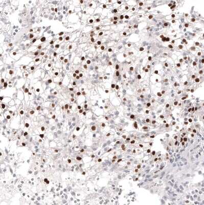 Immunohistochemistry-Paraffin: Pax2 Antibody (CL9469) [NBP2-88934]