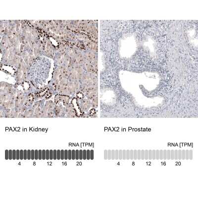 Immunohistochemistry-Paraffin: Pax2 Antibody (CL9469) [NBP2-88934]