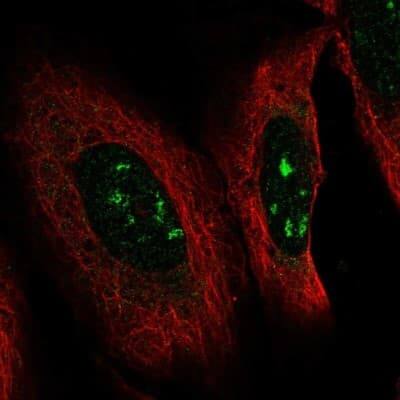 Immunocytochemistry/ Immunofluorescence: Pax2 Antibody [NBP2-57700]