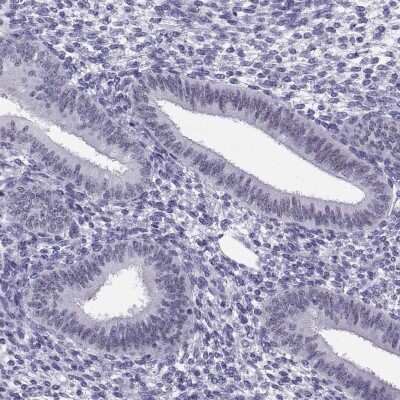 Immunohistochemistry-Paraffin: Pax2 Antibody [NBP2-33496]