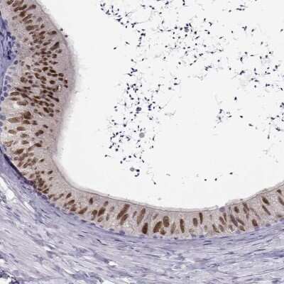 Immunohistochemistry-Paraffin: Pax2 Antibody [NBP2-33496]