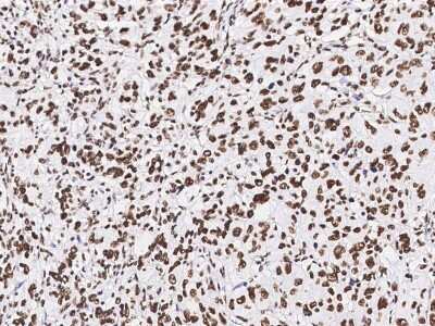 Immunohistochemistry-Paraffin: Pax2 Antibody [NBP2-99012]