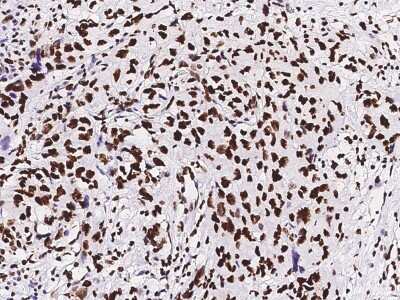 Immunohistochemistry-Paraffin: Pax2 Antibody [NBP2-99013]