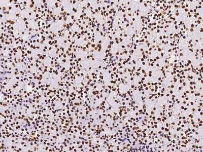 Immunohistochemistry-Paraffin: Pax2 Antibody [NBP2-99013]