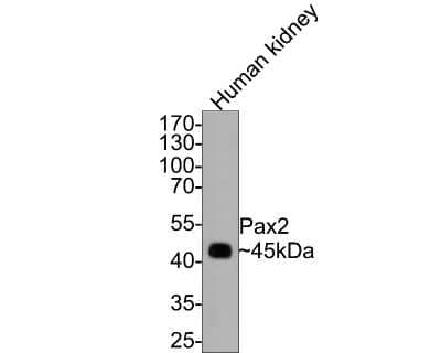 Western Blot: Pax2 Antibody (JJ082-08) [NBP2-67849]