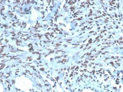 Immunohistochemistry-Paraffin: Pax2 Antibody (PAX2/1104) - Azide and BSA Free [NBP2-79877]