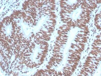 Immunohistochemistry-Paraffin: Pax2 Antibody (PAX2/1104) [NBP2-79742]