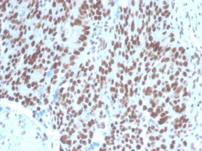 Immunohistochemistry-Paraffin: Pax2 Antibody (PAX2/1104) [NBP2-79742]