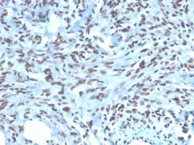 Immunohistochemistry-Paraffin: Pax2 Antibody (PAX2/1104) [NBP2-79742]