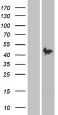 Western Blot: Pax2 Overexpression Lysate [NBP2-04156]