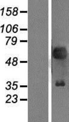 Western Blot: Pax2 Overexpression Lysate [NBP2-07925]