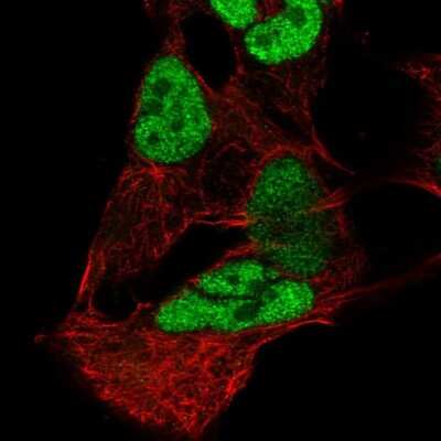 Immunocytochemistry/ Immunofluorescence: Pax3 Antibody [NBP2-32381]