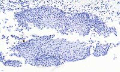 Immunohistochemistry-Paraffin: Pax3 Antibody [NB100-1420]