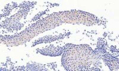 Immunohistochemistry-Paraffin: Pax3 Antibody [NB100-1420]