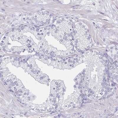 Immunohistochemistry-Paraffin: Pax3 Antibody [NBP2-32381]
