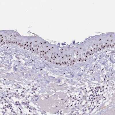 Immunohistochemistry-Paraffin: Pax3 Antibody [NBP2-32381]