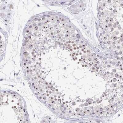 Immunohistochemistry-Paraffin: Pax3 Antibody [NBP2-32381]
