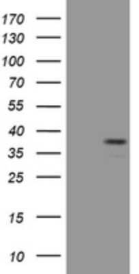 Western Blot: Pax4 Antibody (OTI2F3) [NBP2-46334]