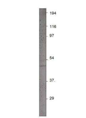 Western Blot: Pax4 Antibody [NBP3-12485]