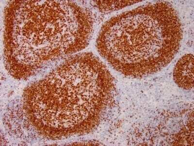 Immunohistochemistry-Paraffin: Pax5/BSAP Antibody (PAX5/3735) - Azide and BSA Free [NBP3-08418]