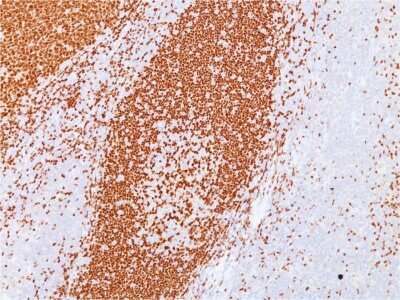 Immunohistochemistry-Paraffin: Pax5/BSAP Antibody (PAX5/3735) [NBP3-07581]