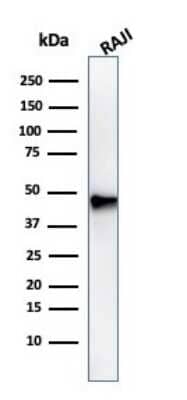 Western Blot: Pax5/BSAP Antibody (PAX5/3735) [NBP3-07581]