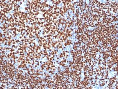 Immunohistochemistry-Paraffin: Pax5/BSAP Antibody (PAX5/3977R) - Azide and BSA Free [NBP3-08310]