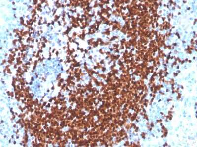 Immunohistochemistry-Paraffin: Pax5/BSAP Antibody (PAX5/3977R) - Azide and BSA Free [NBP3-08310]