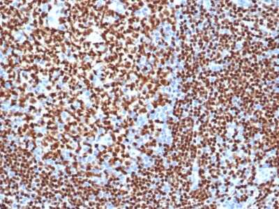 Immunohistochemistry-Paraffin: Pax5/BSAP Antibody (PAX5/3977R) [NBP3-07756]