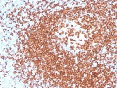 Immunohistochemistry-Paraffin: Pax5/BSAP Antibody (rPAX5/4228) - Azide and BSA Free [NBP3-08419]