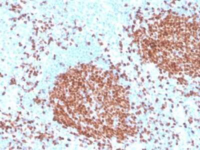 Immunohistochemistry-Paraffin: Pax5/BSAP Antibody (rPAX5/4228) - Azide and BSA Free [NBP3-08419]
