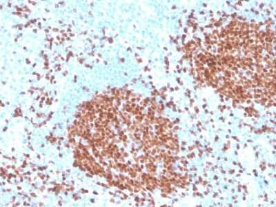 Immunohistochemistry-Paraffin: Pax5/BSAP Antibody (rPAX5/4228) [NBP3-07582]