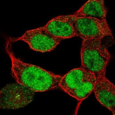 Immunocytochemistry/ Immunofluorescence: Pax6 Antibody (CL5414) [NBP2-61411]