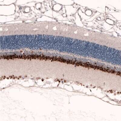 Immunohistochemistry-Paraffin: Pax6 Antibody (CL5414) [NBP2-61411]
