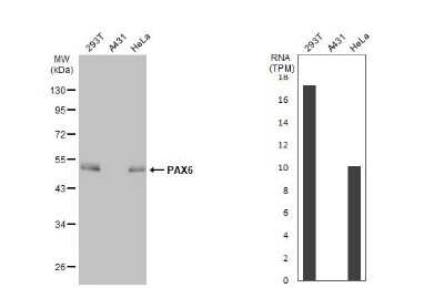 Western Blot: Pax6 Antibody (GT9412) [NBP3-13636]