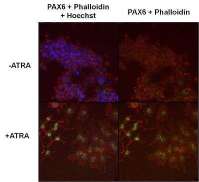 Immunocytochemistry/ Immunofluorescence: Pax6 Antibody [NB300-750]