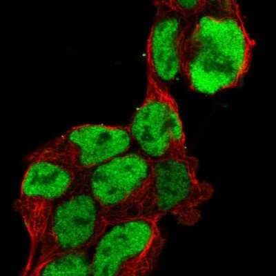 Immunocytochemistry/ Immunofluorescence: Pax6 Antibody [NBP1-89100]