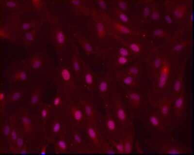Immunocytochemistry/ Immunofluorescence: Pax6 Antibody [NB300-750]