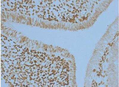 Immunohistochemistry-Frozen: Pax6 Antibody [NBP2-19711]
