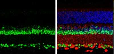 Immunohistochemistry-Paraffin: Pax6 Antibody [NBP2-19711]